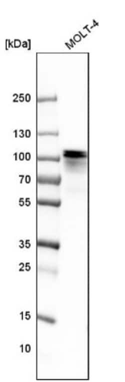 UBTF Antibody, Novus Biologicals 0.1 mL | Buy Online | Novus Biologicals | Fisher Scientific