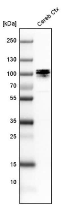 UBTF Antibody, Novus Biologicals 0.1 mL | Buy Online | Novus Biologicals | Fisher Scientific