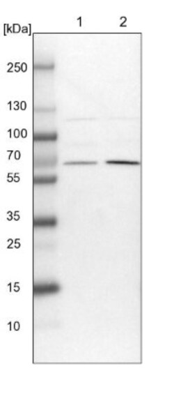 UBXD2 Antibody, Novus Biologicals 0.1mL; Unlabeled:Antibodies, Polyclonal