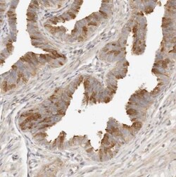 UBXN10 Antibody, Novus Biologicals 25 &mu;L; Unlabeled:Antibodies, Polyclonal