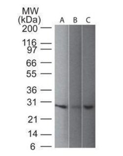 UCH-L1/PGP9.5 Antibody (31A3), Novus Biologicals 20 &mu;g, Unconjugated:Antibodies,