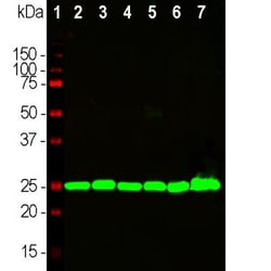 UCH-L1/PGP9.5 Antibody (BH7), Novus Biologicals 0.1 mL; Unconjugated:Antibodies,