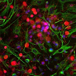 UCH-L1/PGP9.5 Antibody, Novus Biologicals 0.025 mL | Buy Online | Novus Biologicals | Fisher Scientific