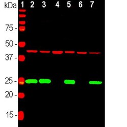 UCH-L1/PGP9.5 Antibody, Novus Biologicals 0.025 mL | Buy Online | Novus Biologicals | Fisher Scientific