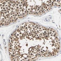 UCH-L3 Antibody, Novus Biologicals:Antibodies:Primary Antibodies