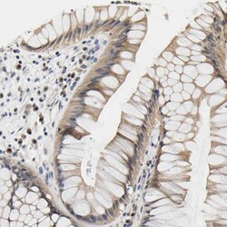 UCH-L3 Antibody, Novus Biologicals:Antibodies:Primary Antibodies