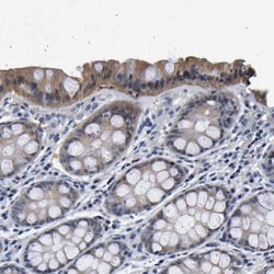 UCH-L3 Antibody, Novus Biologicals:Antibodies:Primary Antibodies