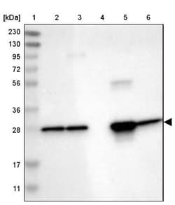 UCH-L3 Antibody, Novus Biologicals:Antibodies:Primary Antibodies