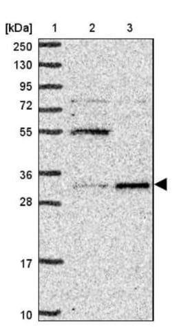 UCK Antibody, Novus Biologicals:Antibodies:Primary Antibodies