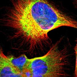 UCKL1 Antibody, Novus Biologicals 25 &mu;L | Buy Online | Novus Biologicals | Fisher Scientific