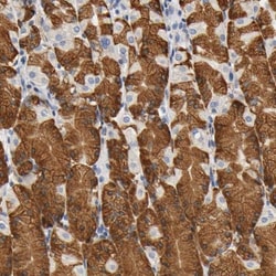 UCKL1 Antibody, Novus Biologicals 25 &mu;L | Buy Online | Novus Biologicals | Fisher Scientific