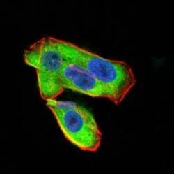 UCP2 Antibody (3F1B9) - BSA Free, Novus Biologicals 0.1mg; Unlabeled:Antibodies,