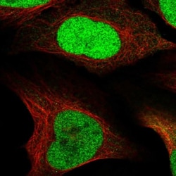 UDP glucose dehydrogenase Antibody, Novus Biologicals:Antibodies:Primary