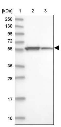 UDP glucose dehydrogenase Antibody, Novus Biologicals:Antibodies:Primary