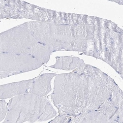 UDP glucose dehydrogenase Antibody, Novus Biologicals:Antibodies:Primary