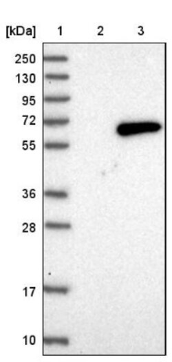 UDP glucose dehydrogenase Antibody, Novus Biologicals 25 &mu;L | Buy Online | Novus Biologicals | Fisher Scientific
