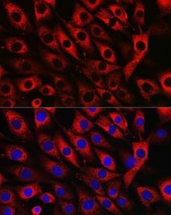 UFL1 Rabbit anti-Human, Mouse, Rat, Polyclonal, Novus Biologicals 20 &mu;g;
