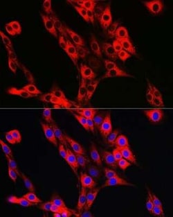 UFL1 Rabbit anti-Human, Mouse, Rat, Polyclonal, Novus Biologicals 20 &mu;g;