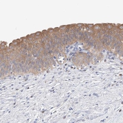 UFL1 Antibody, Novus Biologicals 0.1mL; Unlabeled:Antibodies, Polyclonal