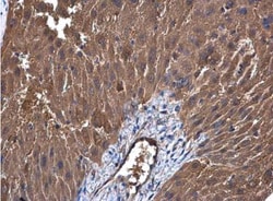 UGP2 Antibody, Novus Biologicals 0.1mL; Unlabeled:Antibodies, Polyclonal