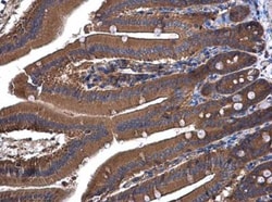 UGP2 Antibody, Novus Biologicals 0.1mL; Unlabeled:Antibodies, Polyclonal