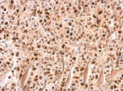 UHRF1 Antibody, Novus Biologicals 0.1mL; Unlabeled:Antibodies, Polyclonal