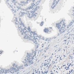 anti-ULBP-1, Polyclonal, Novus Biologicals 0.1mL; Unlabeled:Antibodies,