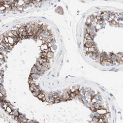 anti-ULBP-1, Polyclonal, Novus Biologicals 0.1mL; Unlabeled:Antibodies,