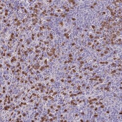 ULBP-3 Antibody, Novus Biologicals 0.1mL; Unlabeled:Antibodies, Polyclonal