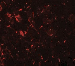 ULK1 Antibody - BSA Free, Novus Biologicals 0.025 mg, Unlabeled:Antibodies,