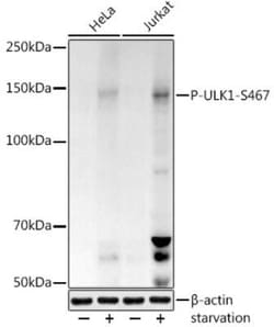 ULK1 Rabbit anti-Human, Mouse, Polyclonal, Novus Biologicals:Antibodies:Primary