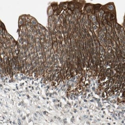 ULK2 Antibody, Novus Biologicals 0.1mL; Unlabeled:Antibodies, Polyclonal