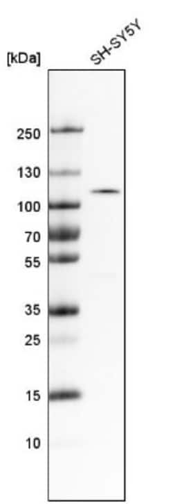 ULK2 Antibody, Novus Biologicals 0.1mL; Unlabeled:Antibodies, Polyclonal