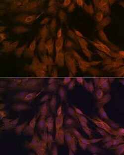 ULK3 Rabbit anti-Human, Mouse, Rat, Clone: 5Z7Z6, Novus Biologicals 100 &mu;g | Buy Online | Novus Biologicals | Fisher Scientific