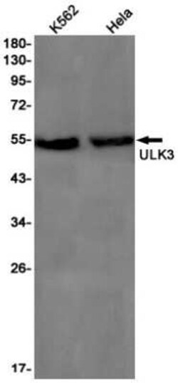 ULK3 Rabbit anti-Human, Clone: S08-7J3, Novus Biologicals 100 &mu;g; Unconjugated:Antibodies,