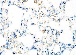 ULK3 Antibody, Novus Biologicals 100 &mu;g | Buy Online | Novus Biologicals | Fisher Scientific