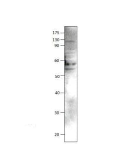 ULK3 Antibody, Novus Biologicals 100 &mu;g | Buy Online | Novus Biologicals | Fisher Scientific