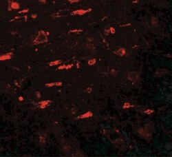 ULK4 Antibody - BSA Free, Novus Biologicals:Antibodies:Primary Antibodies