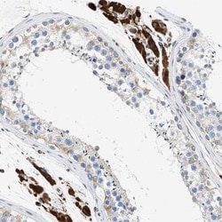 ULK4 Antibody, Novus Biologicals 0.1mL; Unlabeled:Antibodies, Polyclonal
