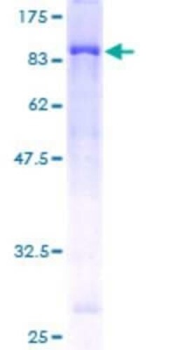 Novus Biologicals Recombinant Human ULK4 GST (N-Term) Protein 10 &mu;g | Buy Online | Novus Biologicals&trade; | Fisher Scientific