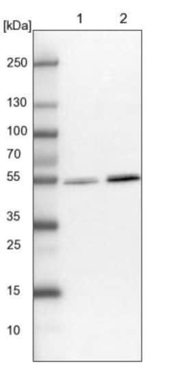 UMPS Antibody, Novus Biologicals 25 &mu;L | Buy Online | Novus Biologicals | Fisher Scientific