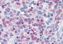 UNC13D/Munc 13-4 Antibody, Novus Biologicals 0.1mg; Unlabeled:Antibodies,