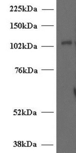 UNC13D/Munc 13-4 Antibody, Novus Biologicals 0.1 mg | Buy Online | Novus Biologicals | Fisher Scientific