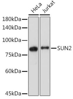 UNC84B Rabbit anti-Human, Mouse, Rat, Clone: 8E8D7, Novus Biologicals 100 &mu;g | Buy Online | Novus Biologicals | Fisher Scientific