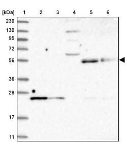 UNC93A Antibody, Novus Biologicals:Antibodies:Primary Antibodies