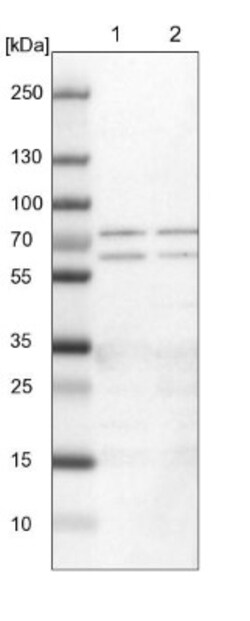 UPF3B Antibody, Novus Biologicals 0.1mL; Unlabeled:Antibodies, Polyclonal