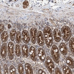 UQCC Antibody, Novus Biologicals:Antibodies:Primary Antibodies