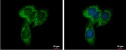 UQCRC1 Antibody, Novus Biologicals 0.1mL; Unlabeled:Antibodies, Polyclonal