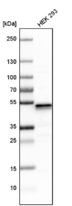 UQCRC1 Antibody, Novus Biologicals 25 &mu;L; Unlabeled:Antibodies, Polyclonal
