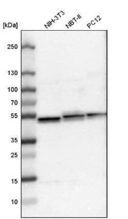 UQCRC1 Antibody, Novus Biologicals 25 &mu;L; Unlabeled:Antibodies, Polyclonal